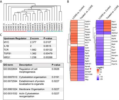 Inhibition of IL-6 in the LCWE Mouse Model of Kawasaki Disease Inhibits Acute Phase Reactant Serum Amyloid A but Fails to Attenuate Vasculitis